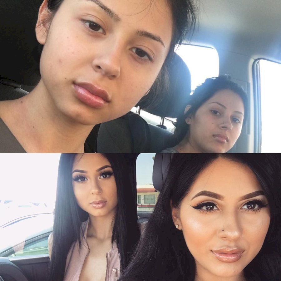 jenny 69 before and after surgery